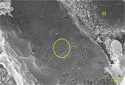 Prominent Receptors of Liver Sinusoidal Endothelial Cells in Liver Homeostasis and Disease